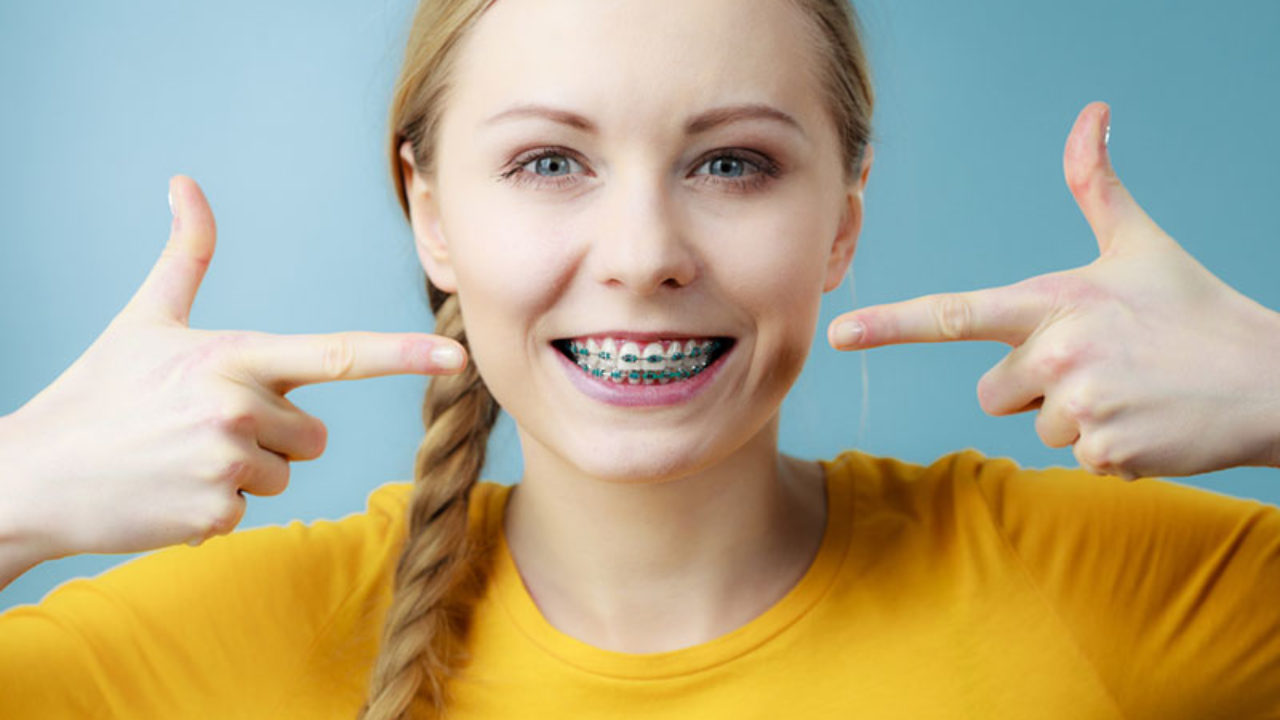 7 Things You Should Know Before You Get Braces Treatment