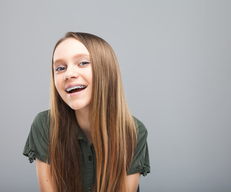 teeth white with braces