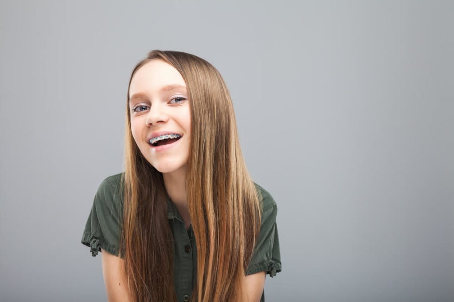 how-to-keep-your-teeth-white-with-braces-914-smiles-tarrytown-braces